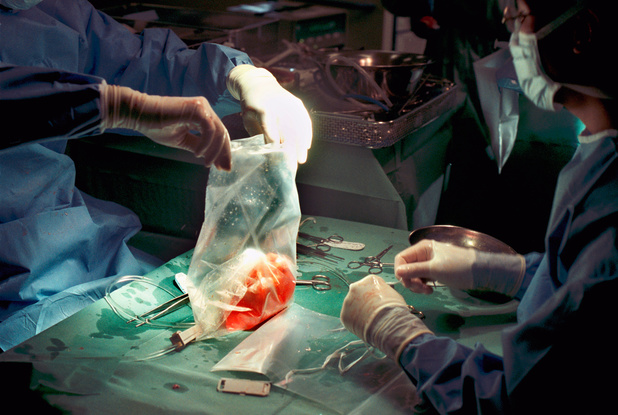 Duitsland: opt-out regeling orgaandonatie in koelkast