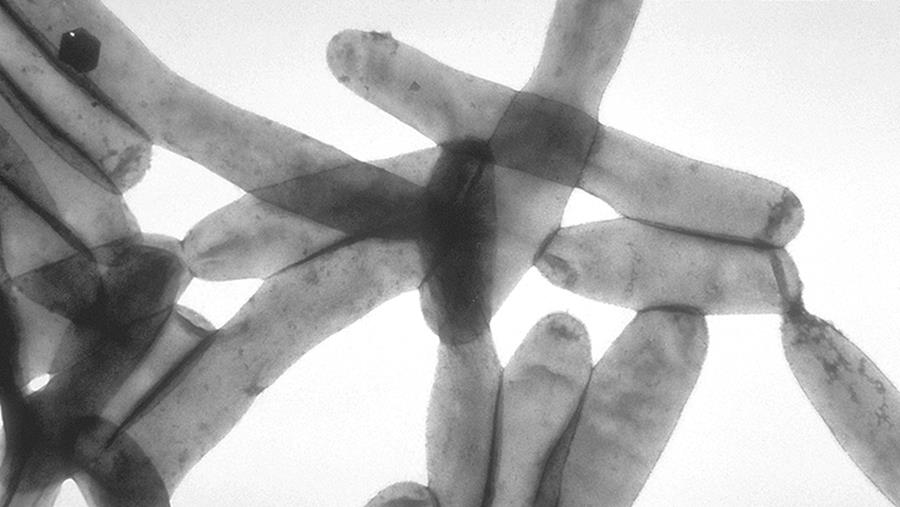 New York: Vier doden door veteranenziekte