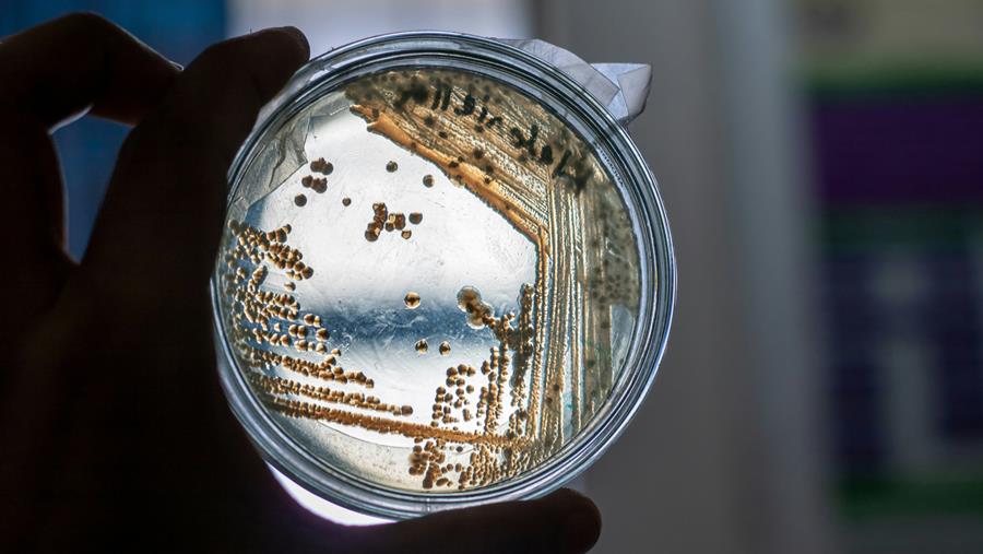 UCLouvain: drie lagen bacteriële envelop werken samen