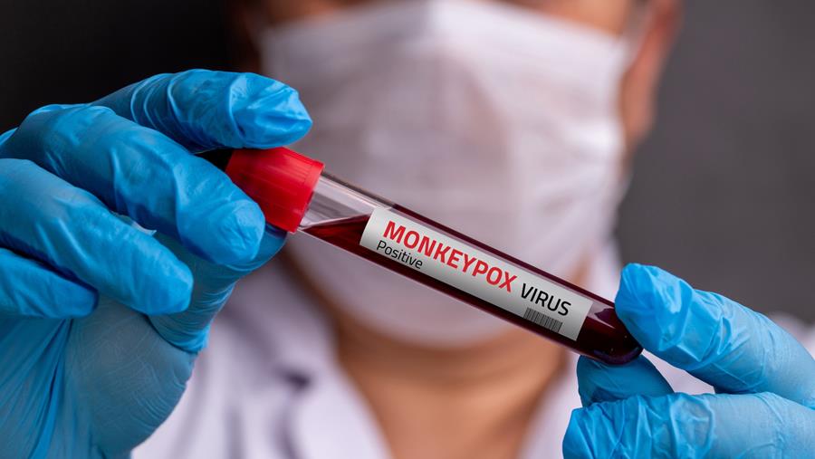 Mpox:  Nieuwe variant ontdekt in Engeland