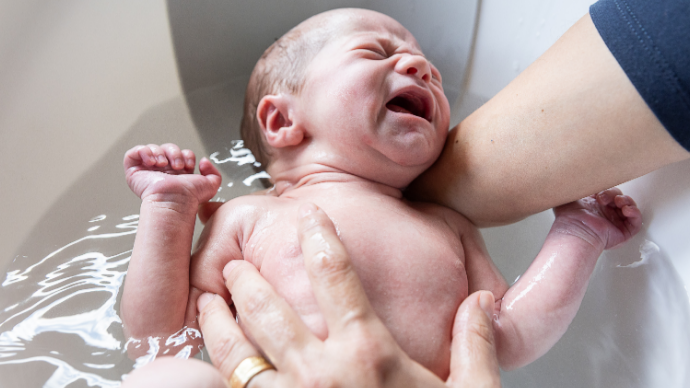 Eén op de vijf geboorten via keizersnede